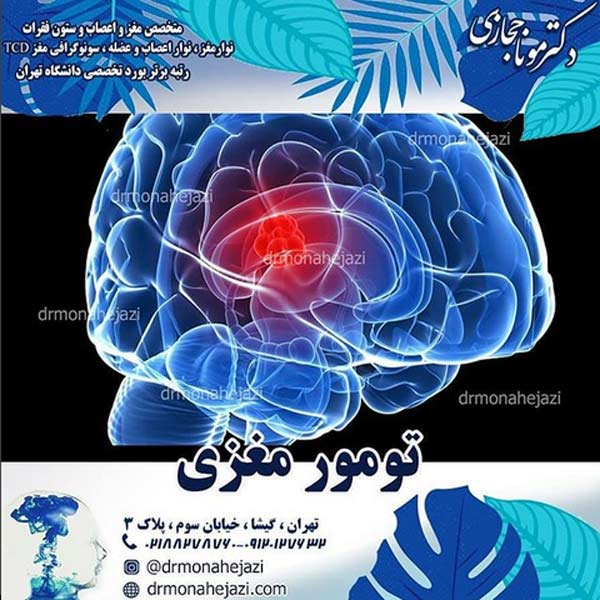 تومور مغزی