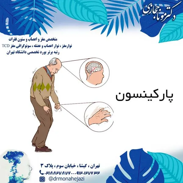 پارکینسون